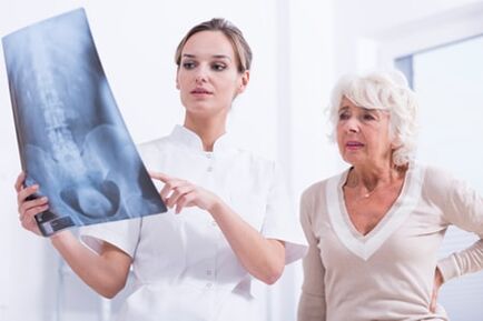 Ο γιατρός δείχνει στον ασθενή μια εικόνα X -Ray της σπονδυλικής στήλης